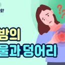 유방의 멍울은 무조건 '유방암'?..유방의 멍울과 덩어리의 다양한 원인과 증상 이미지