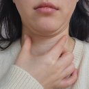 중화산동 피부관리 늘어진 탄력 효과 좋았던 써마지 리프팅 &lt;뽀송에스테틱&gt;