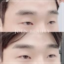별들의전쟁 | 대구 눈썹문신 내돈내산 쌩얼 자신감 되찾은 후기
