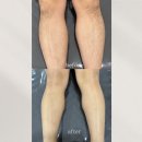 리누에스테틱 이미지