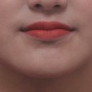 가지런e치과기공소 | 춘천교정치과, 주걱턱 문제를 호소했던 20대 여성 환자 후기