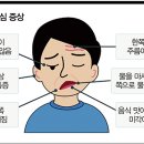 마비