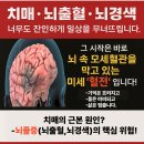 스포츠 스타들이 사랑하는 부항요법(김연아,김연경, BTS 등) 이미지