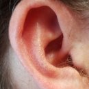 센트럴보청기 이미지