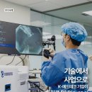 엔도테크 이미지