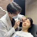 멍이하루 | 리쥬란 시술 후 멍이 들었다구요? 쥬베룩, 보톡스 주사 시술 멍 드는 이유와 관리법