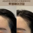 헤어라인 | 강남 반영구 아카데미 투엠메이크업 무통증 헤어라인 교정 후기