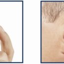 에바다보청기 이미지