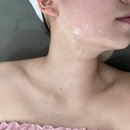 성서3차산업단지(호산로) | [W관리] 성서 이곡동 후스킨앤바디 싸이블로 시술 후기