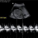 닥터포유의원 | 임신 23주차 배땡김 배뭉침 환도선다 변비 비타민샵