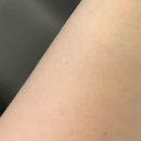 바디 인사이드 이미지