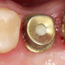 이건치과기공소 이미지