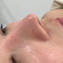 화성 남양 피부관리 남양읍 블랑드보떼 블랙헤드 모공관리 후기