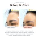 비포성형외과의원 이미지