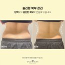 김씨 복부 림프관리 | 지방 제로 도전? '뼈말라' 복부 슬리밍 후기 속 숨겨진 뱃살 순환의 비밀 3가지