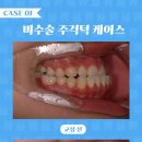 서울 가지런이 치과교정과 치과의원 이미지