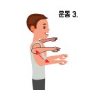 솔재활의학과의원 티스토리