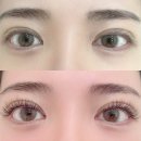 부천바른솔한방병원 | 노테이핑, 유지력 좋은 부천신중동속눈썹연장 벨르밍