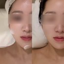 수원-0081 | 미금피부관리 라메드 분당에서 수분 장벽 충전 밸런스케어 후기