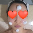 이담에스테틱 | 신림동 피부관리_넙대대한 얼굴형 이담피부왁싱에서 윤곽관리 받은 후기