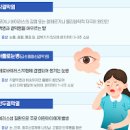 눈충혈 증상 원인 진단 치료 감염성 안구질환 이미지