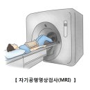 뇌경색 (Cerebral infarction)원인과 치료 이미지