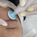 이엔뷰티 | 군산피부관리 이엔뷰티 - 엑소좀스킨부스터,플라즈마 관리 후기 / 여드름 흉터 모공 피부관리 전문점