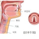 인후통 뜻 원인 인후통 초기증상 좋은 음식 이미지