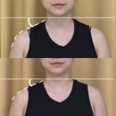 전주 에스테틱 키즈 산후 맞춤관리 잘하는 혁신 아이와