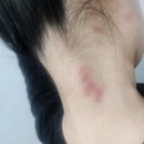 파티마삼성약국 | 포르투갈 포르투 응급실 / 병원진료 후기