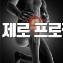 만성 통증 이미지