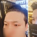 매직헤어라인 이미지