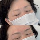 비프리티 이미지