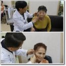 이혈요법 이미지