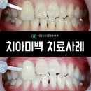 서울새봄플란트치과의원 이미지