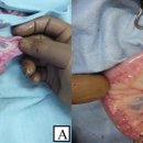 Intestinal gastrointestinal stromal tumor in a cat 이미지