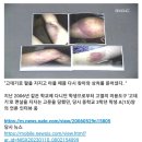 더 글로리에 나온 고데기 고문이 실제 기반이였다니.. 이미지