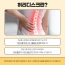 주차편한아산메디칼약국 | 나주허리디스크수술후입원 제대로 알고 가야 덜 무섭더라구요