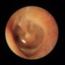 포낙보청기 진주 이미지