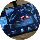 하이트퀸 | 임신 21~24주 일상 | 20주 정밀초음파 시기, 시간, 임당검사, 임당 재검 후기