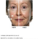 뉴스킨 갈바닉 쓰시는분? 뉴스킨 갈바닉 사용방법 문의요! 이미지