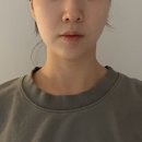 반듯한치과의원 | 안면비대칭 교정 후기, 29 이면 늦은 걸까요?