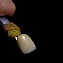 더블유치과기공소 이미지