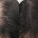 그로우메디 이미지