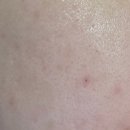 오일스팟 이미지