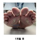 윈메디칼 | “무좀에서 봉와직염까지, 메디컬오의원이 만든 놀라운 변화 – [파주][일산][삼송] 발톱무좀 치료 후기