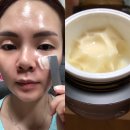 인셀덤 day | 인셀덤 엑티브크림 :: 내돈내산 5통 비운 인셀덤크림 후기 사용방법 피부 반응 비포에프터