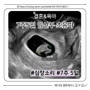 7 | 임신 7주 5일 심장소리 확인 후기, 오산 우먼필산부인과 초음파 7주차