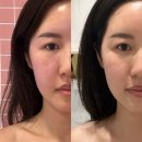 센텀 휴 | 부산센텀에스테틱 '끌리메 센텀점' | 여름철 매끈한 라인을 위한 6in1 토탈케어 [컨투어 페이스 바디...