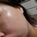 라온메디케어 이미지